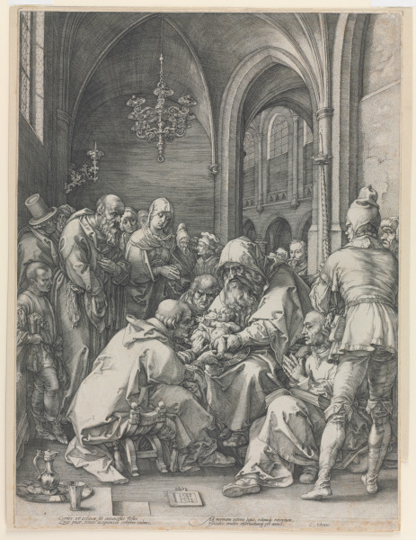 The Circumcision - Image 2