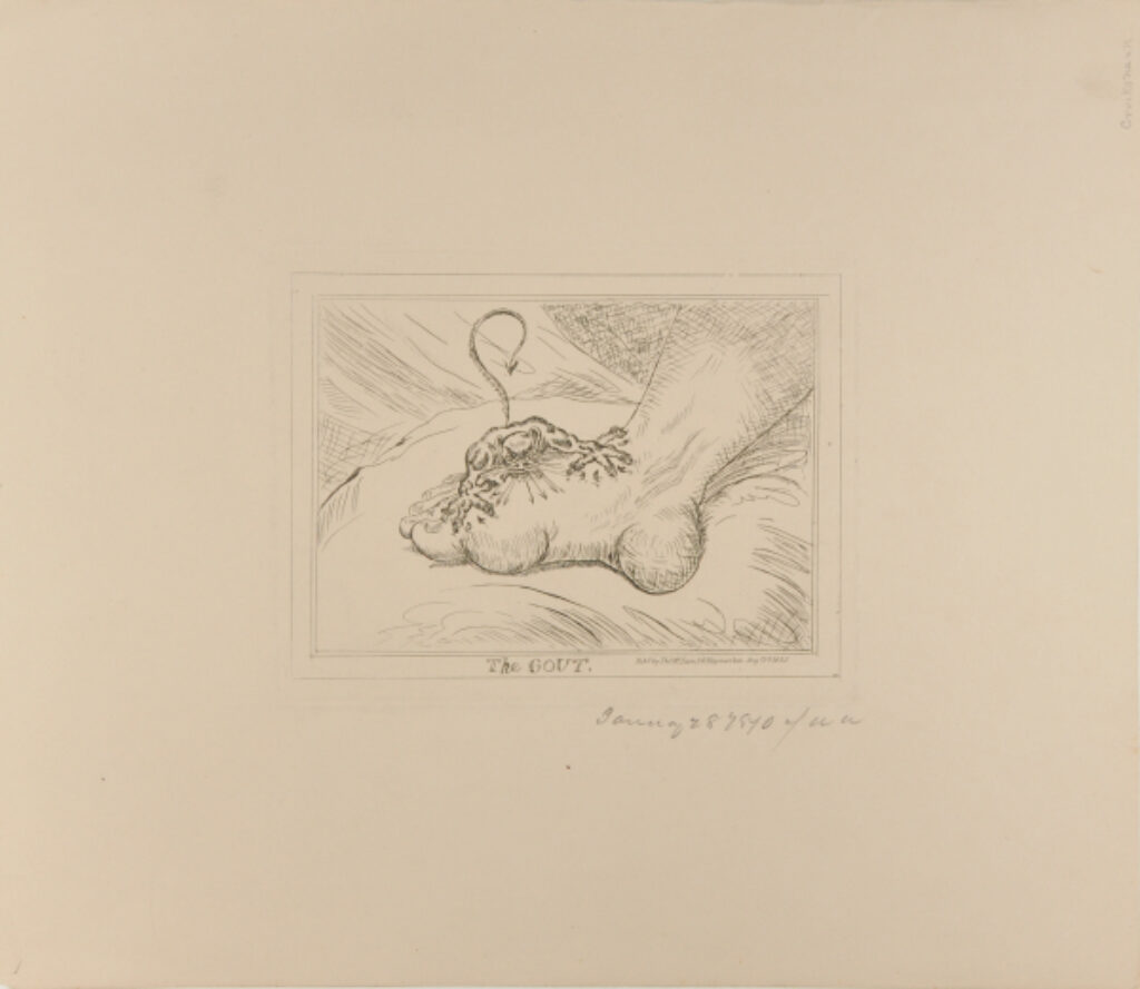 The Gout