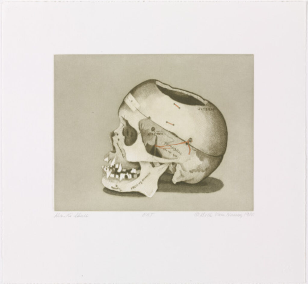 Dr. R.’s Skull (State II) - Image 1