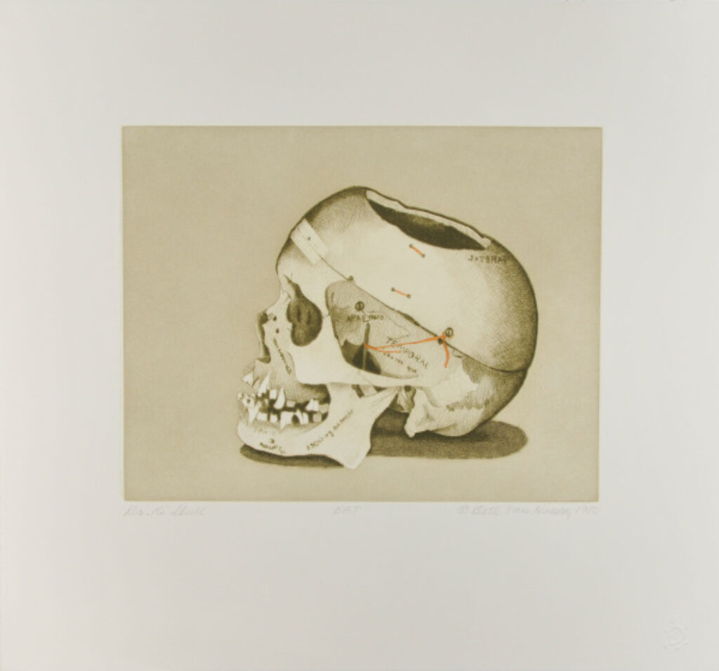 Dr. R.’s Skull (State II) - Image 2