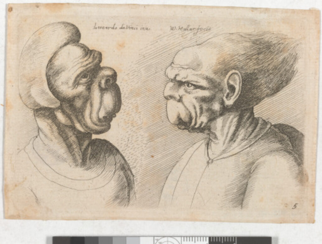 Woman with Huge Upper Lip and Man with Hair Streaming Back